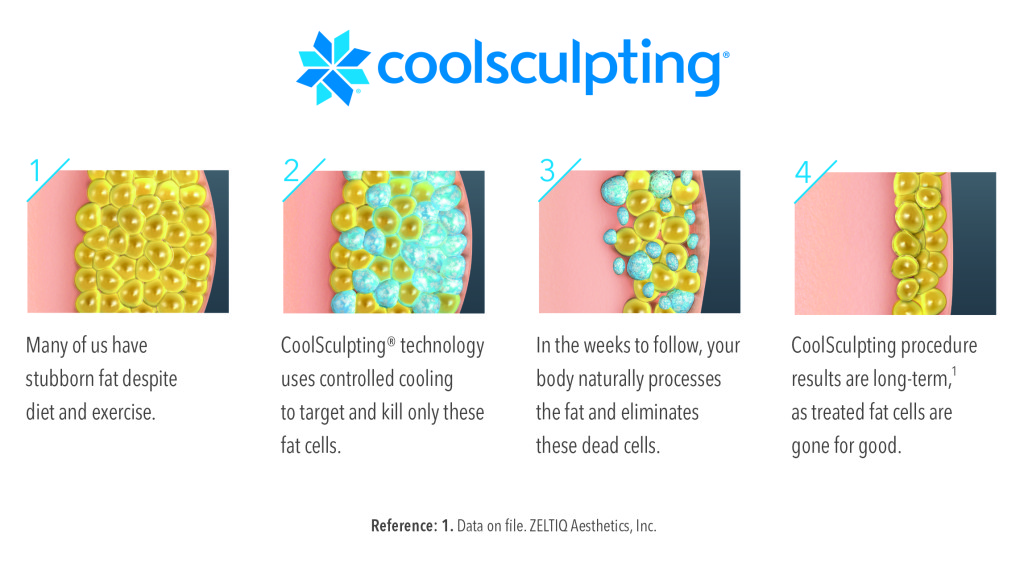 Process of Coolsculpting